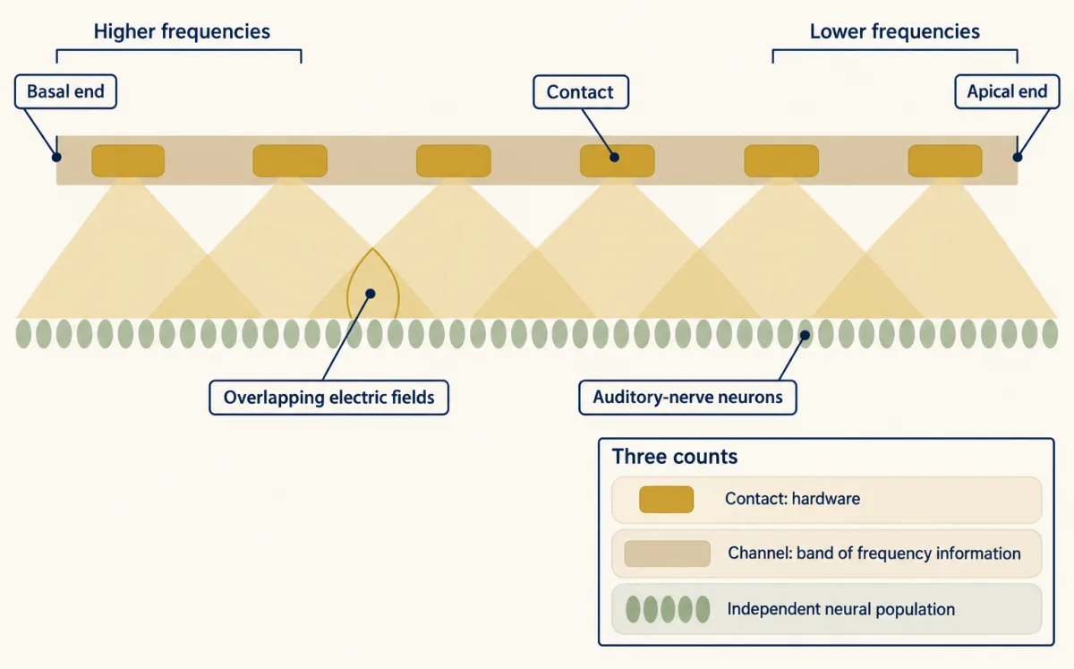 AI-generated illustration: an unrolled, tapering cochlea strip with a row of gold electrode contacts, higher frequencies at the basal end and lower at the apical end. Soft halos from neighbouring contacts overlap on a row of auditory-nerve neurons. An inset separates contact, channel and independent neural population.